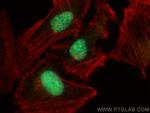 HOXC13 Antibody in Immunocytochemistry (ICC/IF)