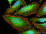 NUDT5 Antibody in Immunocytochemistry (ICC/IF)