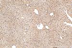 NUDT5 Antibody in Immunohistochemistry (Paraffin) (IHC (P))