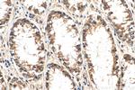 SVCT2 Antibody in Immunohistochemistry (Paraffin) (IHC (P))