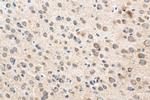SVCT2 Antibody in Immunohistochemistry (Paraffin) (IHC (P))