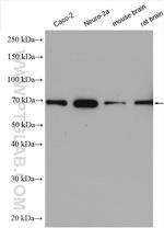 SVCT2 Antibody in Western Blot (WB)