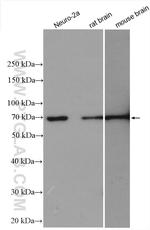 SVCT2 Antibody in Western Blot (WB)