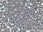 SHQ1 Antibody in Immunohistochemistry (Paraffin) (IHC (P))