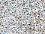 CDK7 Antibody in Immunohistochemistry (Paraffin) (IHC (P))