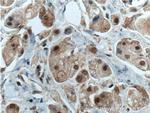 CDK7 Antibody in Immunohistochemistry (Paraffin) (IHC (P))