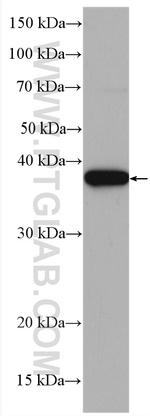 CDK7 Antibody in Western Blot (WB)