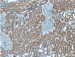PI 3 Kinase p55 gamma Antibody in Immunohistochemistry (Paraffin) (IHC (P))