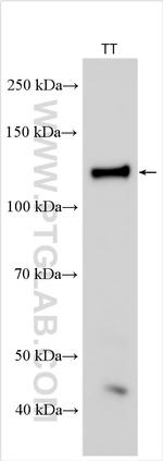 GPNMB Antibody in Western Blot (WB)