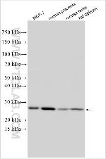 TAF5 Antibody in Western Blot (WB)