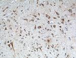 FIBIN Antibody in Immunohistochemistry (Paraffin) (IHC (P))