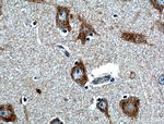 FIBIN Antibody in Immunohistochemistry (Paraffin) (IHC (P))