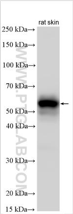 KRT73 Antibody in Western Blot (WB)