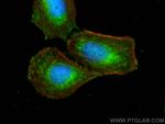 PTGIS Antibody in Immunocytochemistry (ICC/IF)