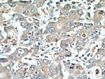 DMBT1 Antibody in Immunohistochemistry (Paraffin) (IHC (P))