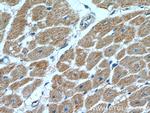 AHNAK2 Antibody in Immunohistochemistry (Paraffin) (IHC (P))