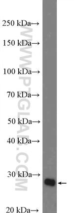TTPA Antibody in Western Blot (WB)