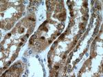 ISOC2 Antibody in Immunohistochemistry (Paraffin) (IHC (P))