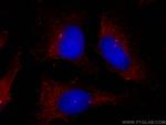 Pericentrin Antibody in Immunocytochemistry (ICC/IF)