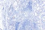 Pericentrin Antibody in Immunohistochemistry (Paraffin) (IHC (P))