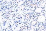 Pericentrin Antibody in Immunohistochemistry (Paraffin) (IHC (P))