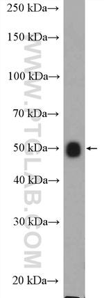 ALG11 Antibody in Western Blot (WB)