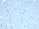 FOXP1 (Transcription Factor) Antibody in Immunohistochemistry (Paraffin) (IHC (P))