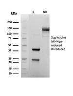 FOXP1 (Transcription Factor) Antibody in Immunoelectrophoresis (IE)