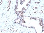 FOXP1 (Transcription Factor) Recombinant Mouse Monoclonal Antibody (rFOXP1/6902)