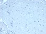 FOXP1 (Transcription Factor) Antibody in Immunohistochemistry (Paraffin) (IHC (P))
