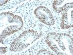 FOXP1 (Transcription Factor) Recombinant Rabbit Monoclonal Antibody (FOXP1, 44R)