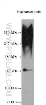 Neurocan Antibody in Western Blot (WB)