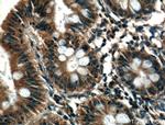 RAB10 Antibody in Immunohistochemistry (Paraffin) (IHC (P))