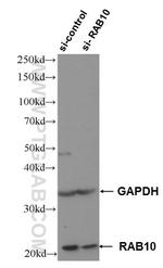 RAB10 Antibody in Western Blot (WB)