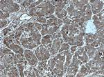 ITGAV Antibody in Immunohistochemistry (Paraffin) (IHC (P))