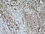 ITGAV Antibody in Immunohistochemistry (Paraffin) (IHC (P))