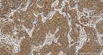 ECHDC3 Antibody in Immunohistochemistry (Paraffin) (IHC (P))