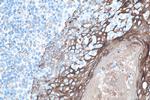Cytokeratin 8 Antibody in Immunohistochemistry (Paraffin) (IHC (P))