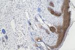 Cytokeratin 8 Antibody in Immunohistochemistry (Paraffin) (IHC (P))