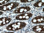Cytokeratin 8 Antibody in Immunohistochemistry (Paraffin) (IHC (P))
