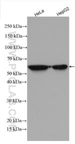 Cytokeratin 8 Antibody in Western Blot (WB)