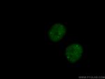 CCDC124 Antibody in Immunocytochemistry (ICC/IF)