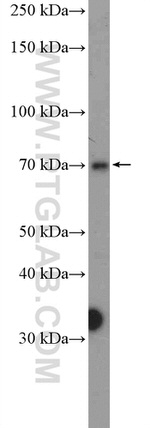 PRMT5 Antibody in Western Blot (WB)