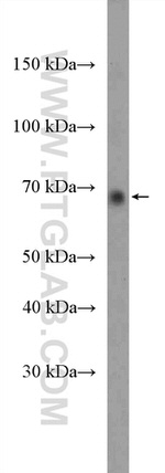 PRMT5 Antibody in Western Blot (WB)