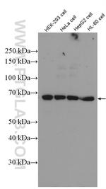 PRMT5 Antibody in Western Blot (WB)