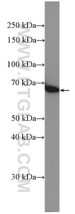 PRMT5 Antibody in Western Blot (WB)