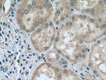 MT1A Antibody in Immunohistochemistry (Paraffin) (IHC (P))