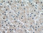MT1A Antibody in Immunohistochemistry (Paraffin) (IHC (P))