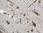 PTN Antibody in Immunohistochemistry (Paraffin) (IHC (P))