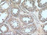 DMXL2 Antibody in Immunohistochemistry (Paraffin) (IHC (P))